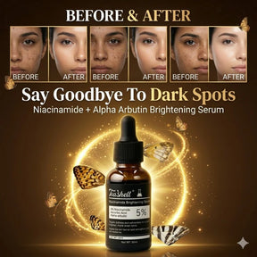 Teashell Niacinamide Brightening Serum | Fade Dark Spots, Acne Marks & Even Skin Tone