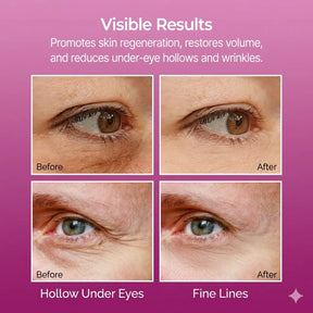 Dr.Melaxin Cemenrete Calcium Volume Multi Balm 9g