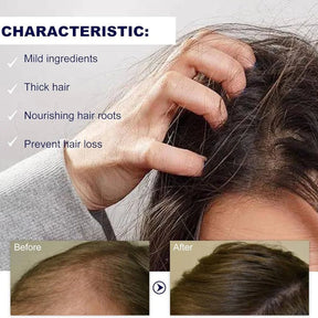 Bare Anatomy Advanced Hair Growth Roll-On Serum | 3% Redensyl + 4% Anagain + 2% Baicapil + 5% Rosemary | Direct Scalp Application for Thicker, Stronger Hair