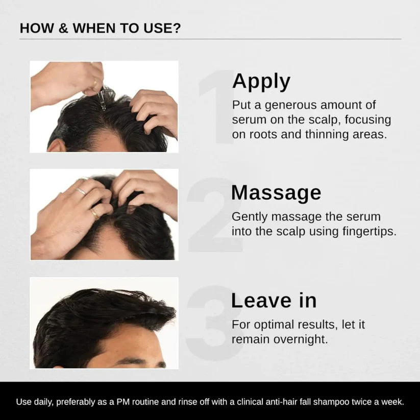 Bare Anatomy Advanced Hair Growth Roll-On Serum | 3% Redensyl + 4% Anagain + 2% Baicapil + 5% Rosemary | Direct Scalp Application for Thicker, Stronger Hair