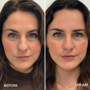 Dr.Melaxin Cemenrete Calcium Volume Multi Balm 9g