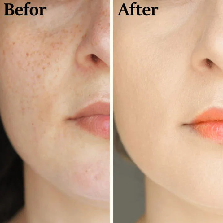 Teashell Niacinamide Brightening Serum | Fade Dark Spots, Acne Marks & Even Skin Tone