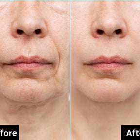 Dr.Melaxin Cemenrete Calcium Volume Multi Balm 9g