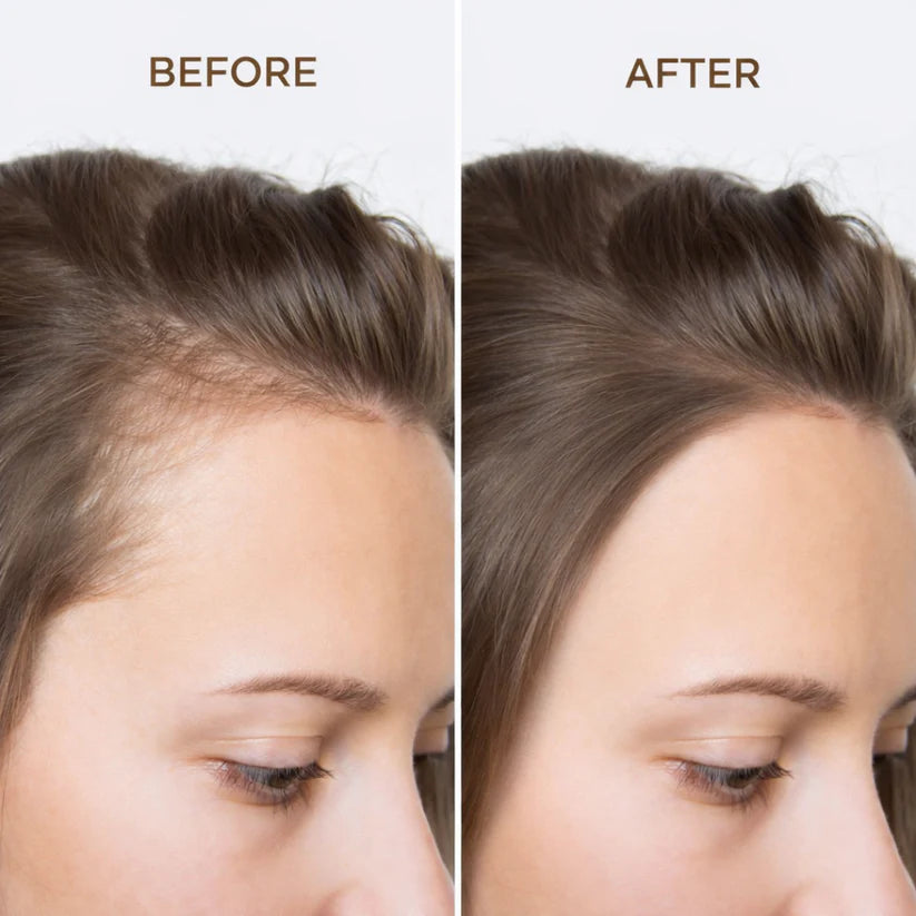 Bare Anatomy Advanced Hair Growth Roll-On Serum | 3% Redensyl + 4% Anagain + 2% Baicapil + 5% Rosemary | Direct Scalp Application for Thicker, Stronger Hair