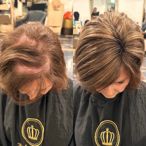 Bare Anatomy Advanced Hair Growth Roll-On Serum | 3% Redensyl + 4% Anagain + 2% Baicapil + 5% Rosemary | Direct Scalp Application for Thicker, Stronger Hair