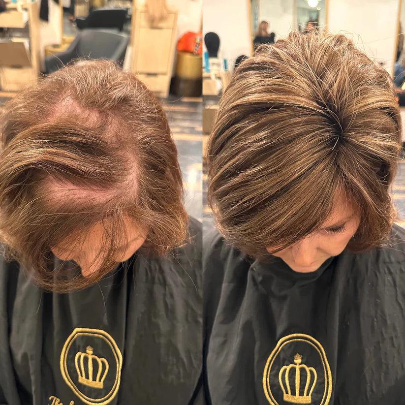 Bare Anatomy Advanced Hair Growth Roll-On Serum | 3% Redensyl + 4% Anagain + 2% Baicapil + 5% Rosemary | Direct Scalp Application for Thicker, Stronger Hair