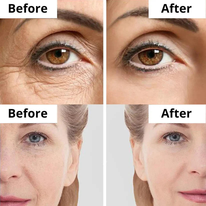 Dr.Melaxin Cemenrete Calcium Volume Multi Balm 9g