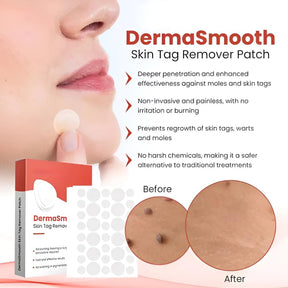 DermaSmooth Skin Tag Remover Patch