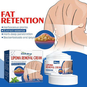 Lipoma Removal Cream (IMPORTED)
