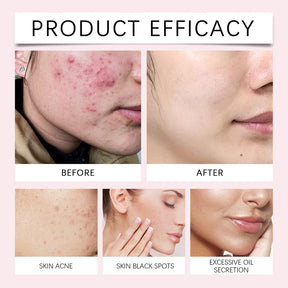 Kojic Acid and Turmeric Cleansing Pads