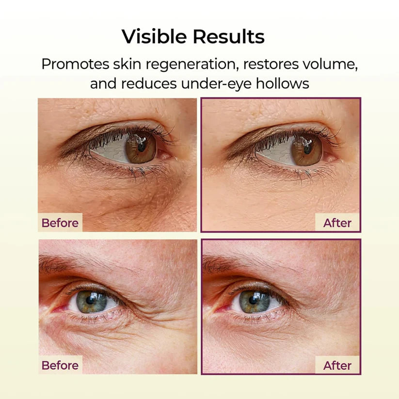 Dr.Melaxin Cemenrete Calcium Volume Multi Balm 9g