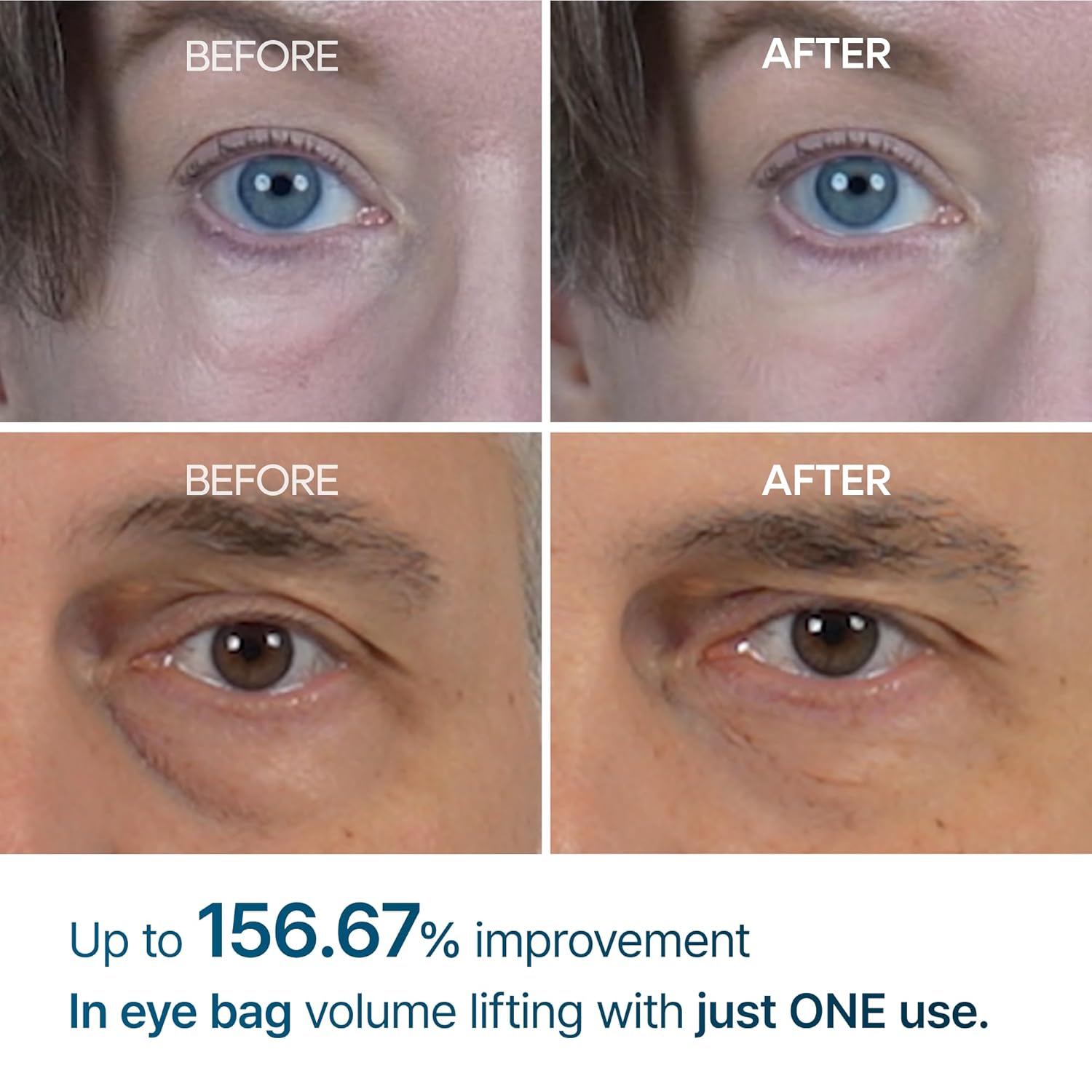 Dr.Melaxin Eyephalt Retinol Eyebag Cream