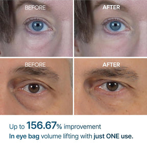 Dr.Melaxin Eyephalt Retinol Eyebag Cream