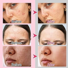 Kojic Acid and Turmeric Cleansing Pads