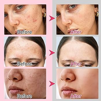 Kojic Acid and Turmeric Cleansing Pads