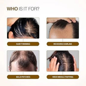 Bare Anatomy Advanced Hair Growth Roll-On Serum | 3% Redensyl + 4% Anagain + 2% Baicapil + 5% Rosemary | Direct Scalp Application for Thicker, Stronger Hair