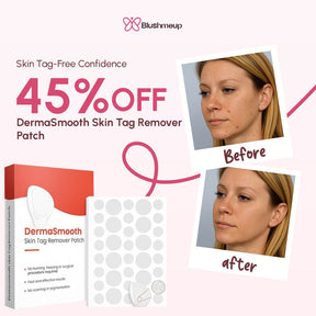DermaSmooth Skin Tag Remover Patch