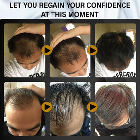 FEG PLUS Hair Spray – 100% Original, Money Back Guarantee