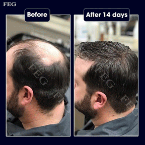 FEG PLUS Hair Spray – 100% Original, Money Back Guarantee