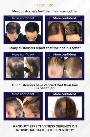 FEG PLUS Hair Spray – 100% Original, Money Back Guarantee