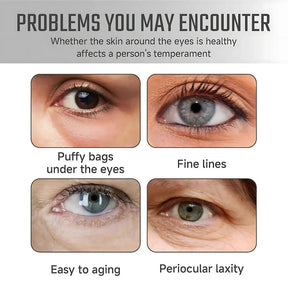 Lutein Anti-Wrinkle Serum – Firm & Radiant Skin
